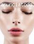 Botox en Estepona, Botox Malaga, Botox