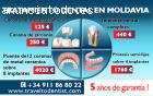 Implantología dental en Moldavia